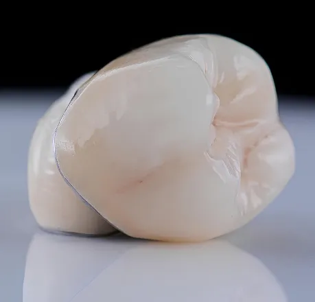 Dental Crowns