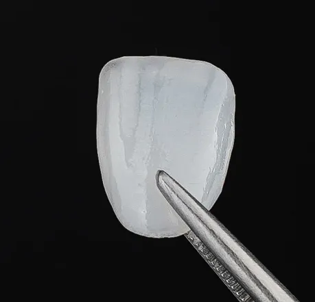Dental Veneers